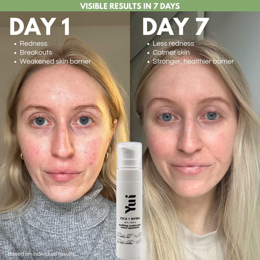 CICA + Bifida Soothing Moisturizer